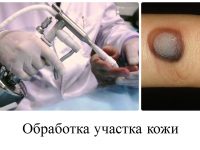 Использование азота