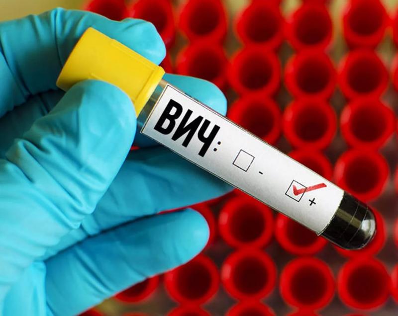 ВИЧ-инфекция